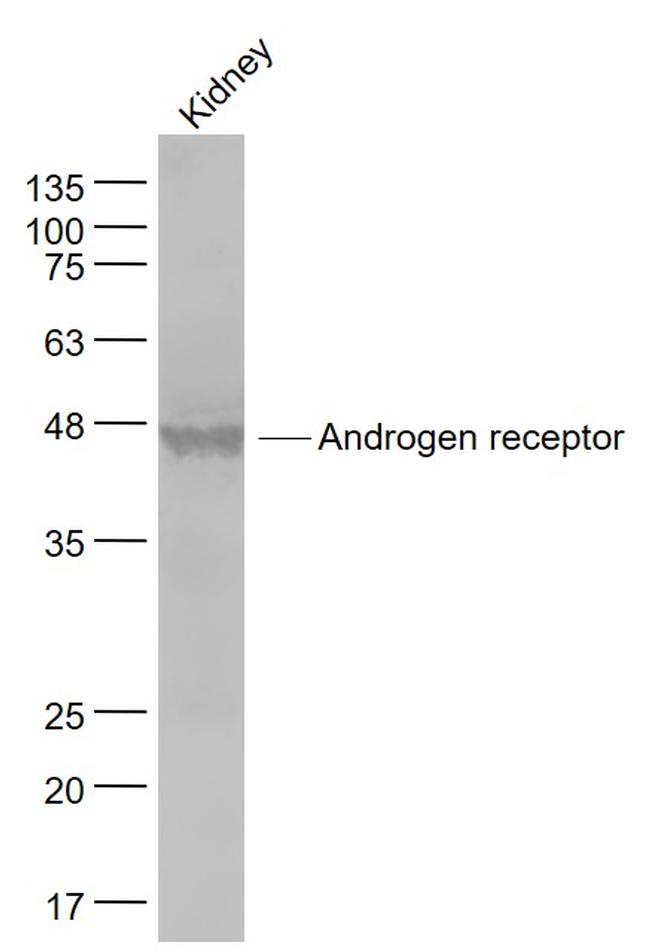 Androgen receptor Antibody in Western Blot (WB)