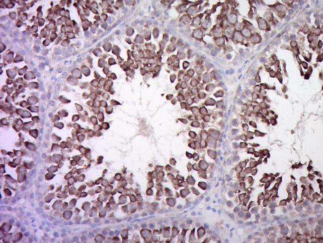 Calcitonin receptor Antibody in Immunohistochemistry (Paraffin) (IHC (P))