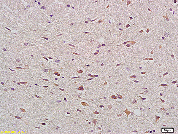 Bax Antibody in Immunohistochemistry (Paraffin) (IHC (P))