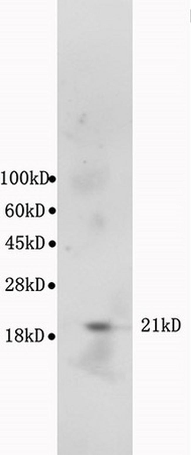 Bax Antibody in Western Blot (WB)