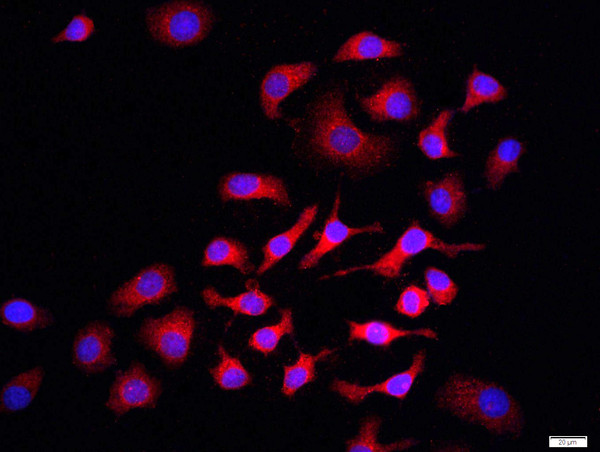 PI3 kinase p85 alpha subunit Antibody in Immunocytochemistry (ICC/IF)