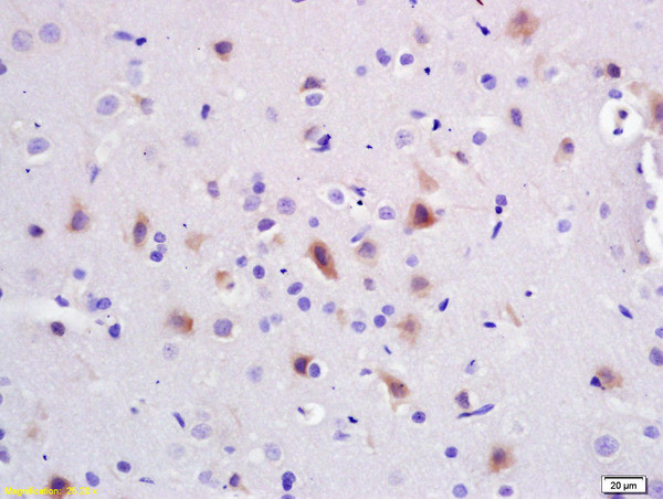 PI3 kinase p85 alpha subunit Antibody in Immunohistochemistry (Paraffin) (IHC (P))