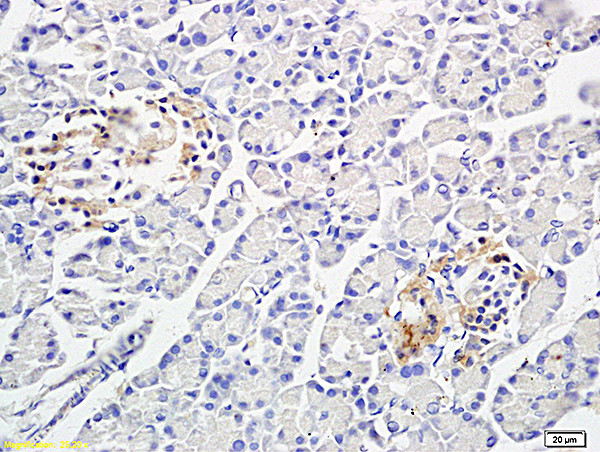 PP-1B Antibody in Immunohistochemistry (Paraffin) (IHC (P))