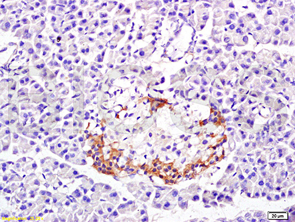 PP-1B Antibody in Immunohistochemistry (Paraffin) (IHC (P))