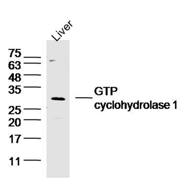 GTP cyclohydrolase 1 Antibody in Western Blot (WB)