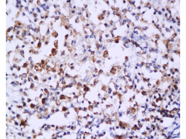 Caspase-6 Antibody in Immunohistochemistry (Paraffin) (IHC (P))