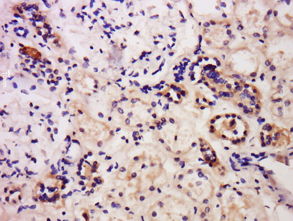 Caspase-6 Antibody in Immunohistochemistry (Paraffin) (IHC (P))