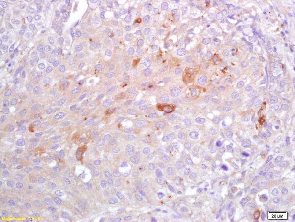 CRP Antibody in Immunohistochemistry (Paraffin) (IHC (P))