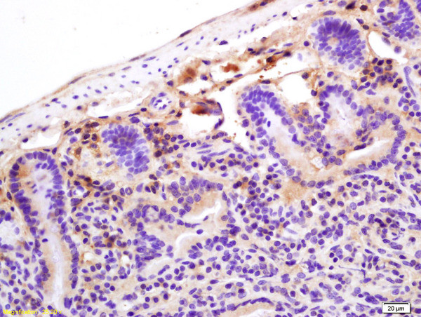 CRP Antibody in Immunohistochemistry (Paraffin) (IHC (P))