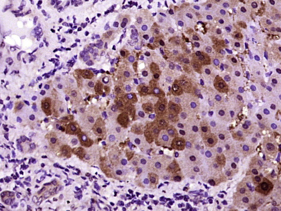 CRP Antibody in Immunohistochemistry (Paraffin) (IHC (P))