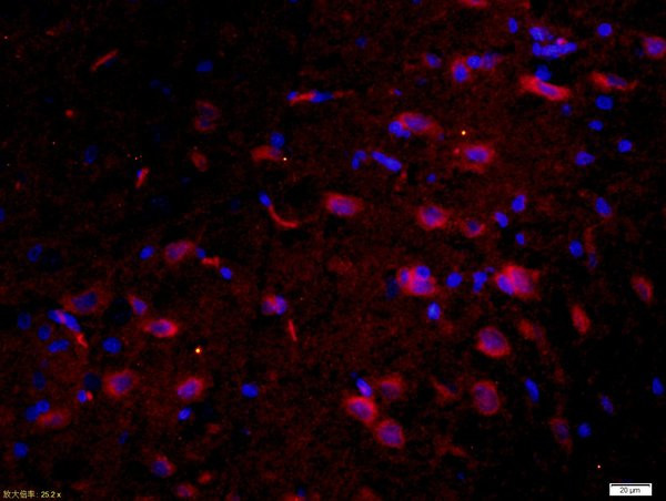 Tau protein Antibody in Immunohistochemistry (Paraffin) (IHC (P))