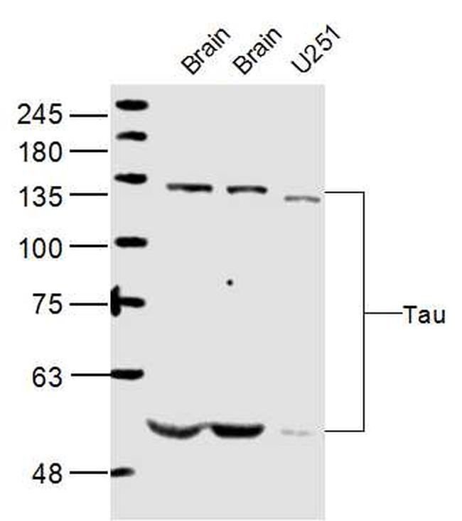Tau protein Antibody in Western Blot (WB)