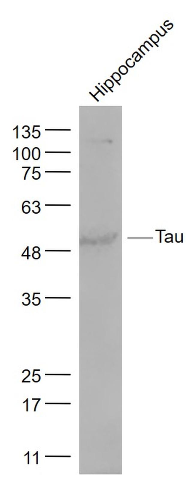 Tau protein Antibody in Western Blot (WB)