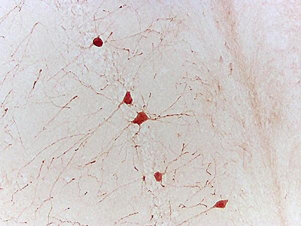 Neurotrophin 3 Antibody in Immunohistochemistry (Paraffin) (IHC (P))