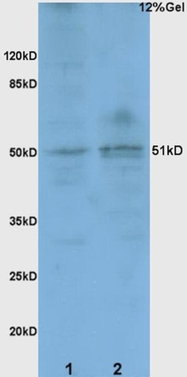 BACE1 Antibody in Western Blot (WB)