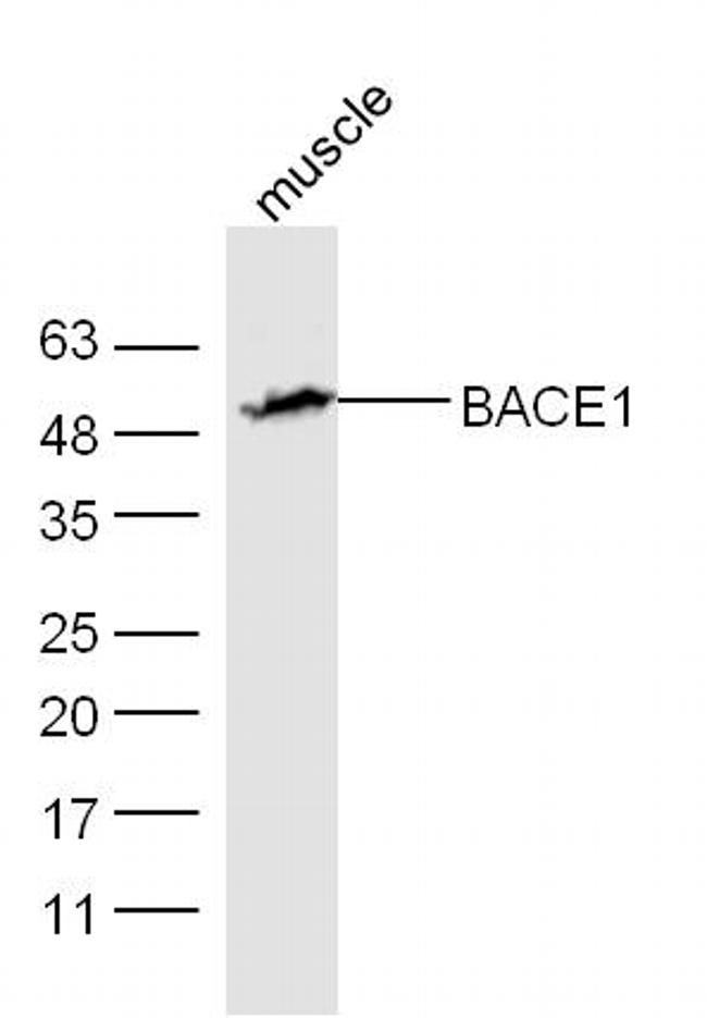 BACE1 Antibody in Western Blot (WB)