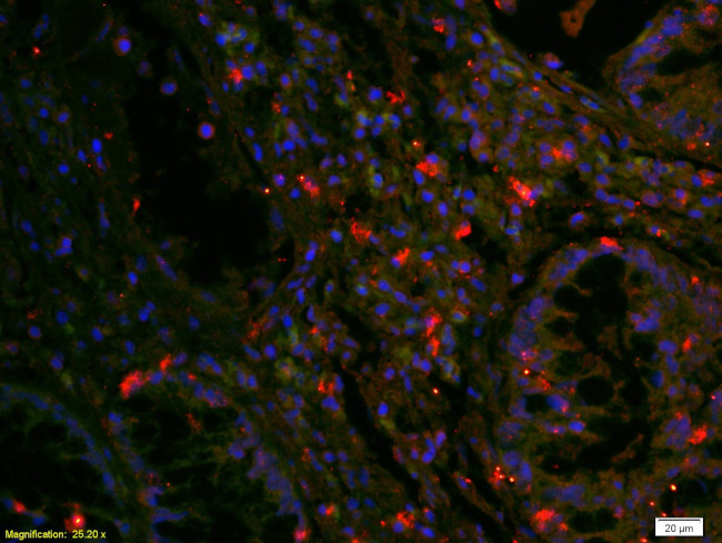 EGFR Antibody in Immunohistochemistry (Paraffin) (IHC (P))