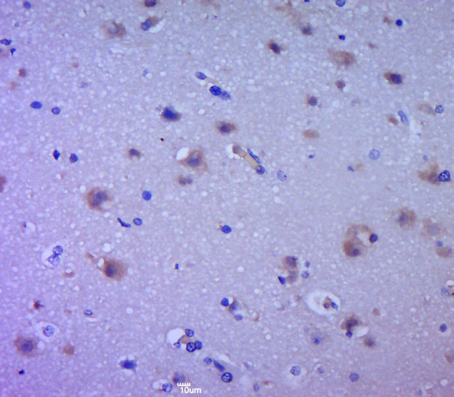 EGFR Antibody in Immunohistochemistry (Paraffin) (IHC (P))