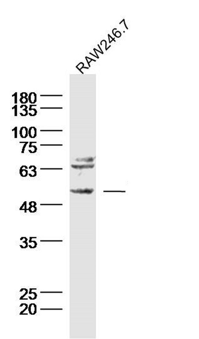 Neurokinin B receptor Antibody in Western Blot (WB)