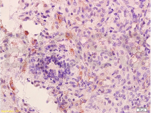 VEGFR1 Antibody in Immunohistochemistry (Paraffin) (IHC (P))