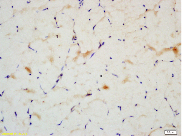 IRS-2 Antibody in Immunohistochemistry (Paraffin) (IHC (P))