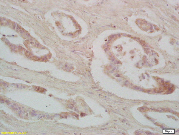 IRS-2 Antibody in Immunohistochemistry (Paraffin) (IHC (P))