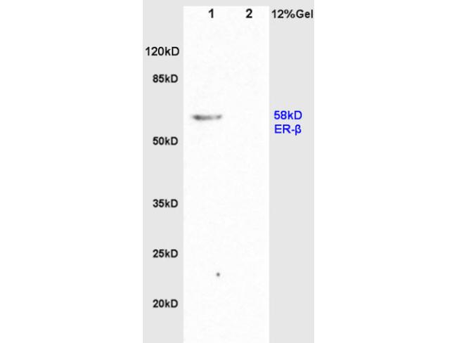 Estrogen Receptor alpha + beta Antibody in Western Blot (WB)