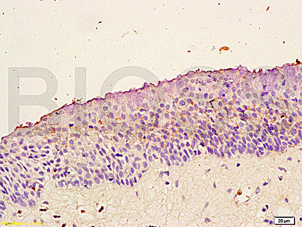 TrkB Antibody in Immunohistochemistry (Paraffin) (IHC (P))