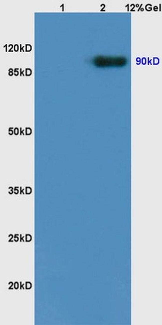 TrkB Antibody in Western Blot (WB)