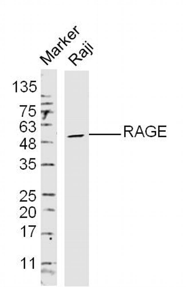 RAGE Antibody in Western Blot (WB)