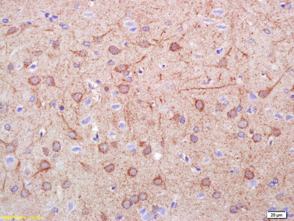 DOPA Decarboxylase Antibody in Immunohistochemistry (Paraffin) (IHC (P))