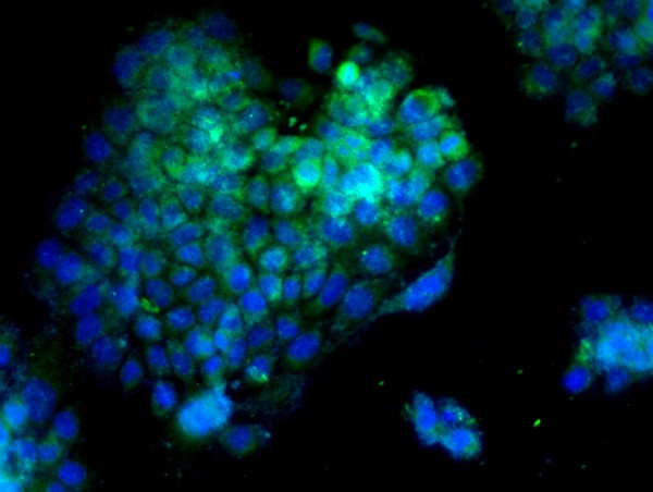 PTP1B Antibody in Immunocytochemistry (ICC/IF)