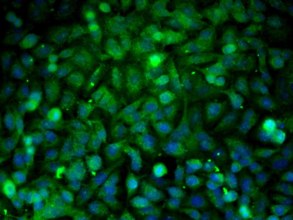 PTP1B Antibody in Immunocytochemistry (ICC/IF)