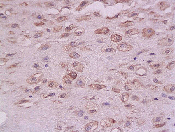 PTP1B Antibody in Immunohistochemistry (Paraffin) (IHC (P))