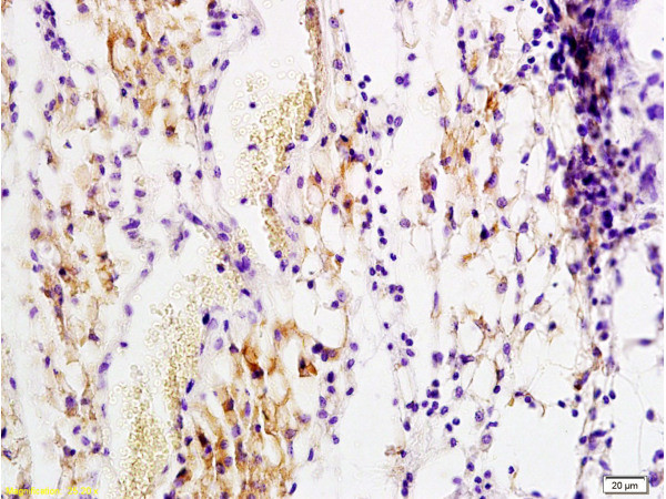 PDGF B Antibody in Immunohistochemistry (Paraffin) (IHC (P))