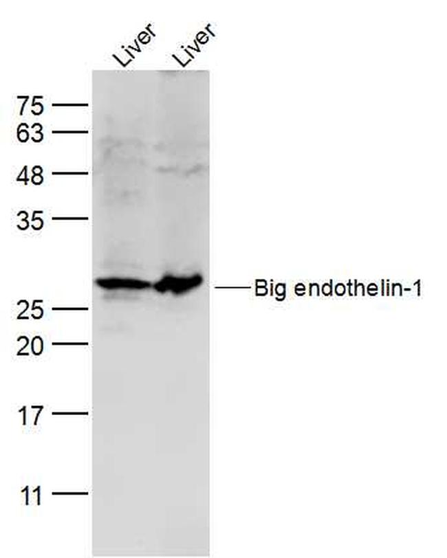 Preproendothelin 1 Antibody in Western Blot (WB)
