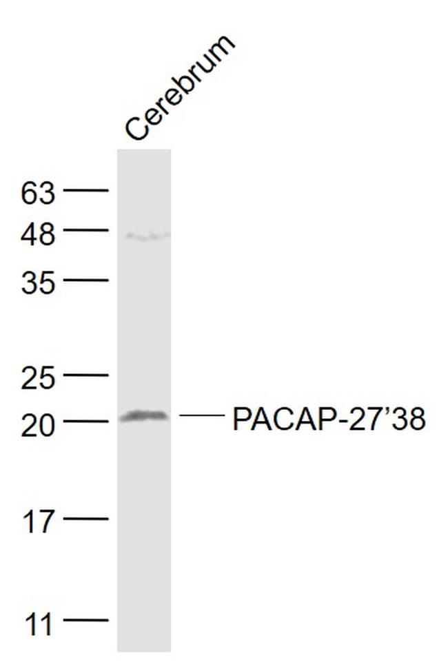 PACAP-27/38 Antibody in Western Blot (WB)