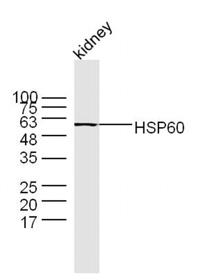 HSP60 Antibody in Western Blot (WB)