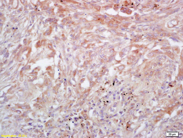 Trk A + B + C Antibody in Immunohistochemistry (Paraffin) (IHC (P))