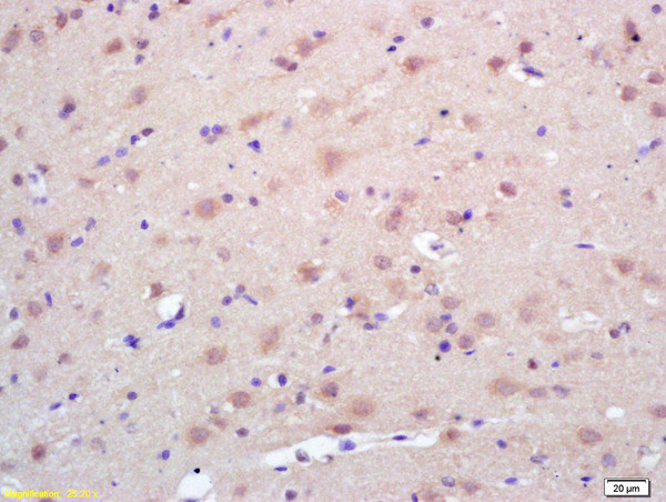 Trk A + B + C Antibody in Immunohistochemistry (Paraffin) (IHC (P))