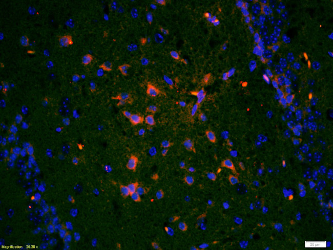 TrkA Antibody in Immunohistochemistry (Paraffin) (IHC (P))