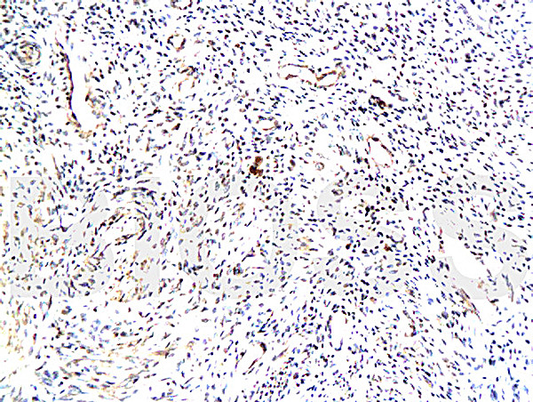 TrkA Antibody in Immunohistochemistry (Paraffin) (IHC (P))