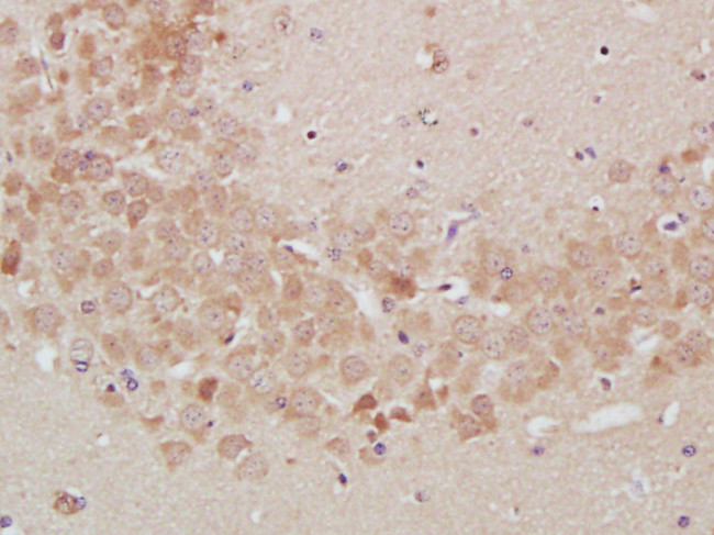 TrkA Antibody in Immunohistochemistry (Paraffin) (IHC (P))