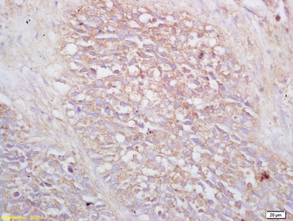 VPAC2R Antibody in Immunohistochemistry (Paraffin) (IHC (P))