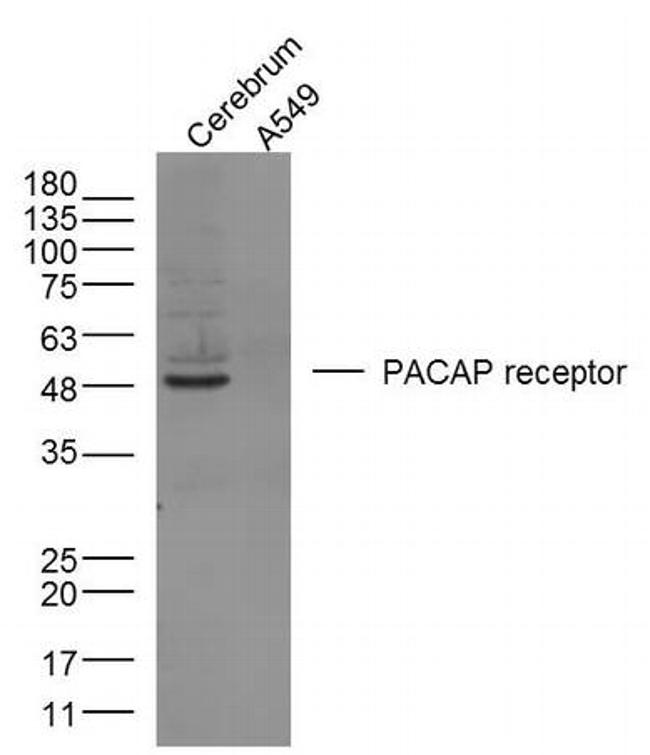 PACAP receptor 1 Antibody in Western Blot (WB)