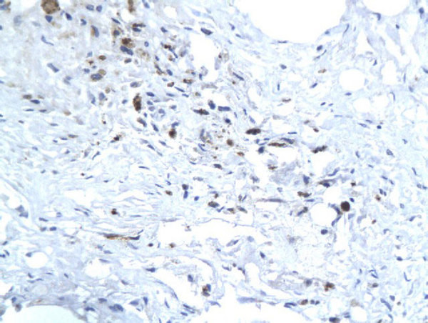 Hepatitis E Virus ORF3 Antibody in Immunohistochemistry (Paraffin) (IHC (P))