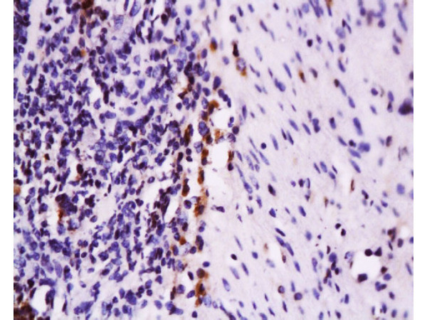 CD95 Antibody in Immunohistochemistry (Paraffin) (IHC (P))