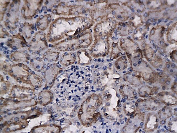 bFGF Antibody in Immunohistochemistry (Paraffin) (IHC (P))