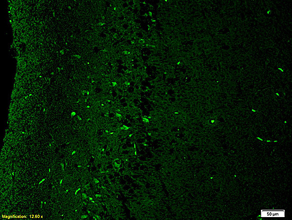 NMDAR2B Antibody in Immunohistochemistry (Paraffin) (IHC (P))