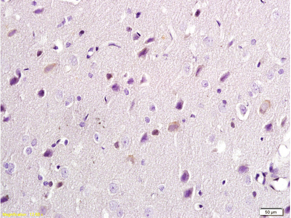 NMDAR2B Antibody in Immunohistochemistry (Paraffin) (IHC (P))